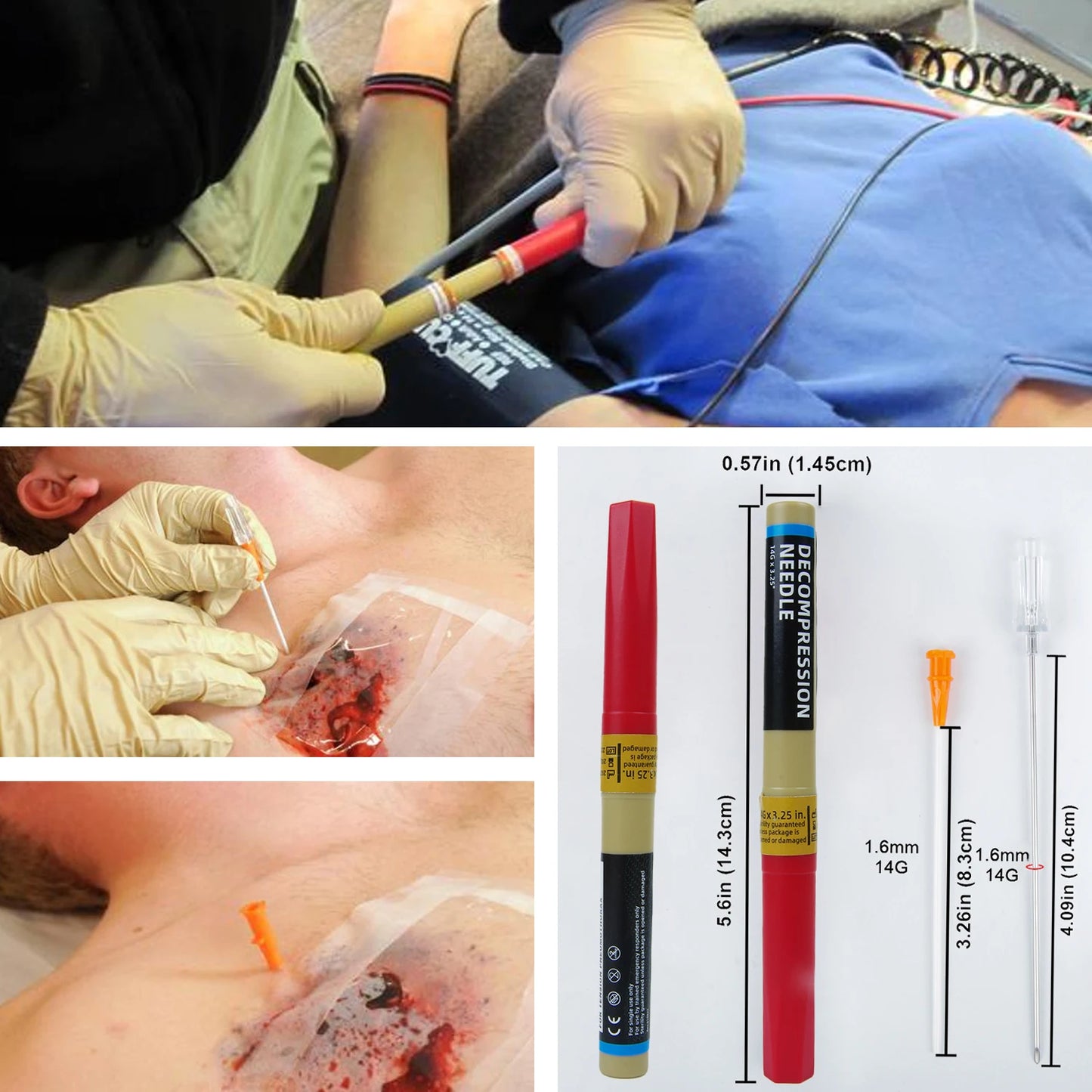 Sanke Emergency Pneumothorax Decompression Needle for Trauma First Aid Kit